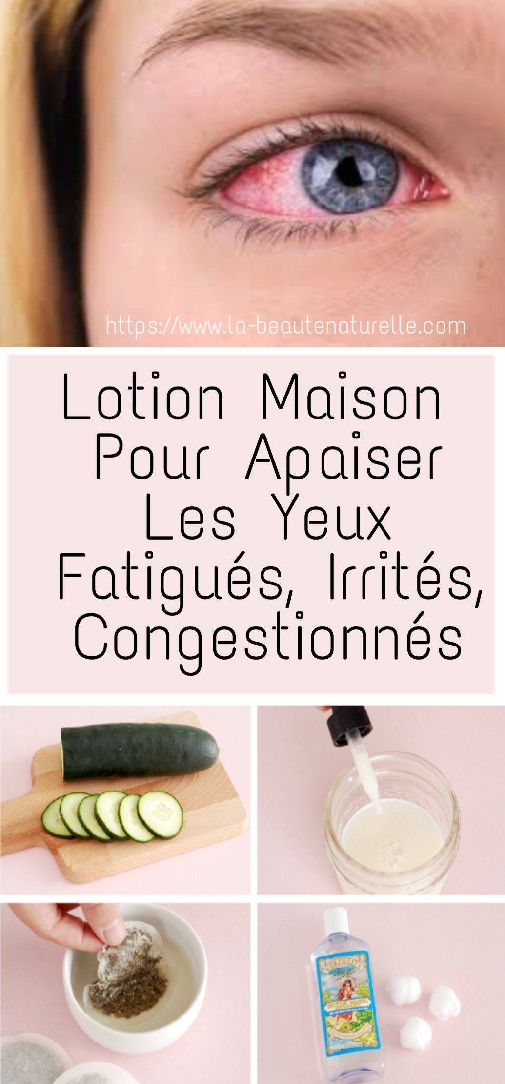 6 remèdes maison naturels pour les yeux fatigués