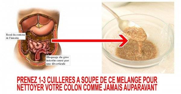 Recettes qui peuvent nettoyer et construire le gros intestin